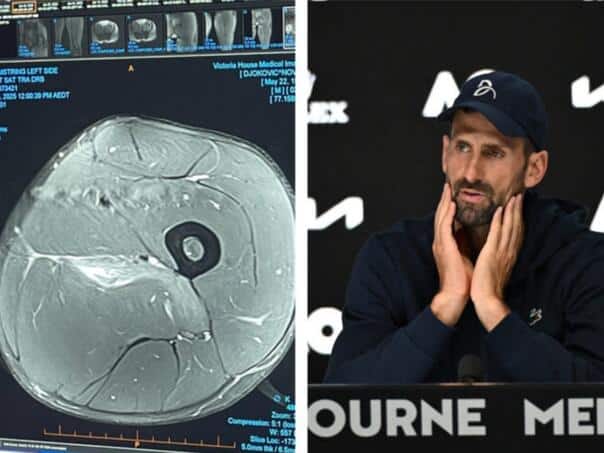 Known Doctor about Djokovic’s injury, discovered how much you might pause