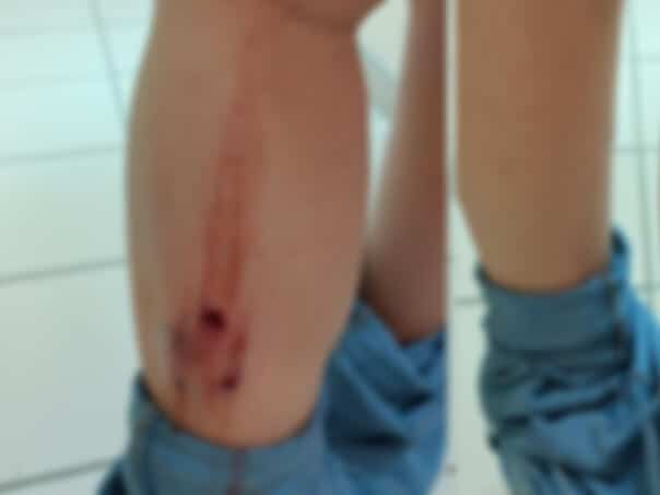 Pack dogs bite the woman at the UKC RS in Banja Luka