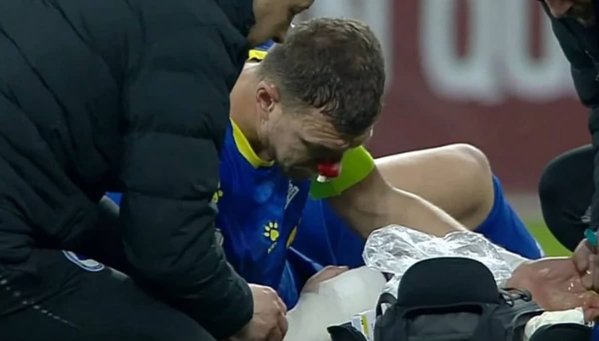 Jack at the game broke his nose so he laughed cheer fans on his account