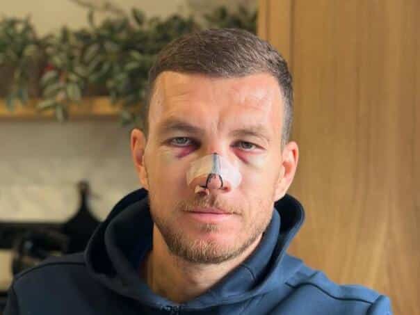Spanish Marca wrote about Jack’s injury: “Warrior unprecedented”