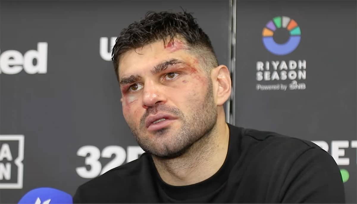 See how Hrgovic looks like after one of the hardest career struggles