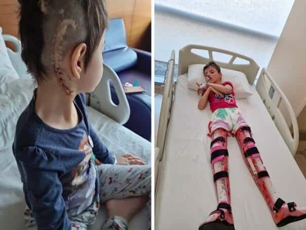 It takes 32 to brain surgery: Help her together!