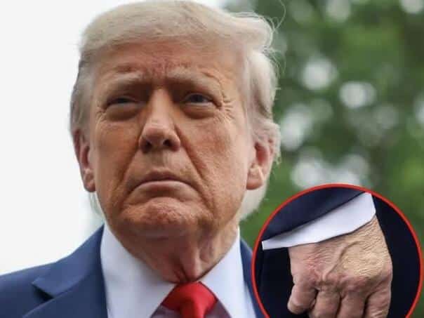 How serious is Donald Trump’s Diagnosis?