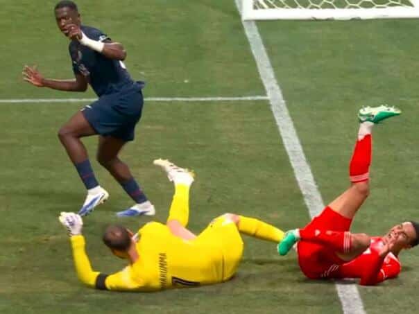 Horror on the field: Donnarma unhappily broke his leg Musia