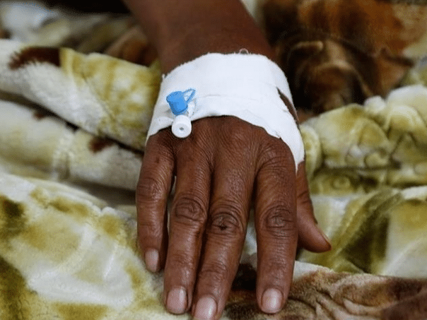 58 people died in the Nigeria from Cholera