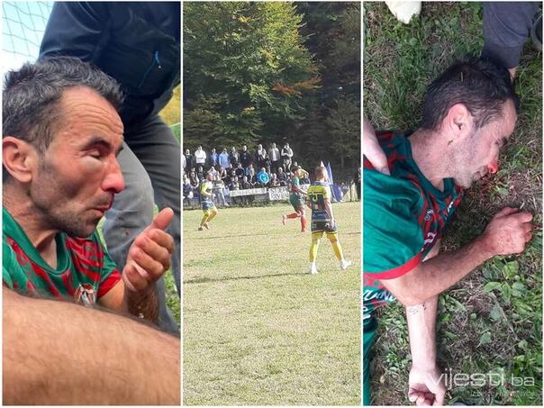 Disgrace at a football match near Lukavac: A football player was beaten, the players fought with sticks, chased with batons and threatened with a gun