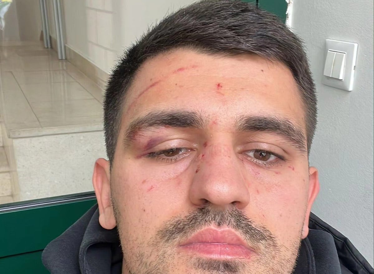 Cheating after the match in Croatia: Guests made shocking accusations and photos
