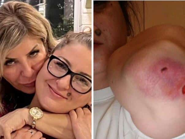 Arrested member "Panther" on suspicion of beating the daughter of Džemila Talić Gabriel