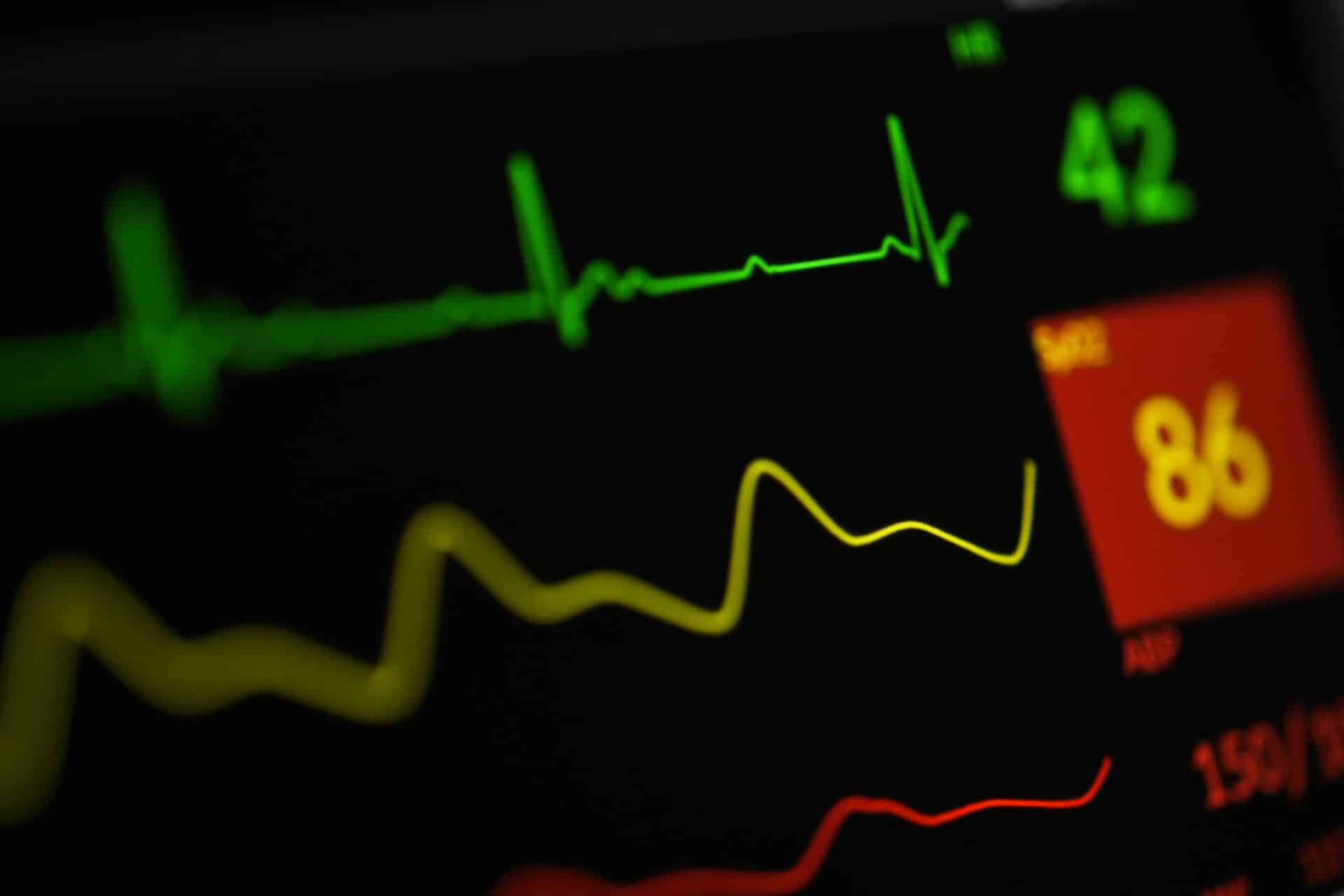The Ministry of Civil Affairs initiated the process: BiH one step closer to Eurotransplant