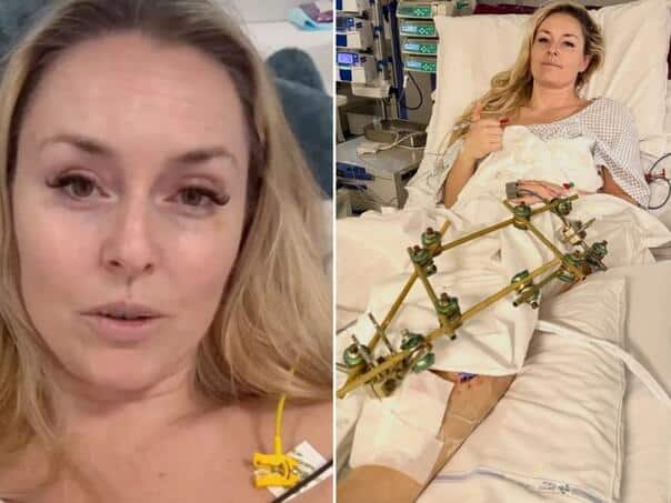 Lindsey Vonn has two more surgeries