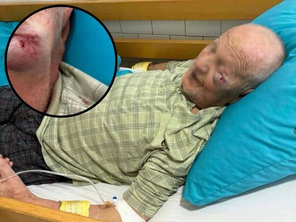 Disturbing: This is what an old man (84) who was attacked in the Gračanica Hospital looks like