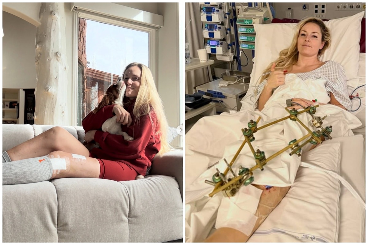 Lindsey Vonn has spoken out about retirement after her horrific fall at the Olympics