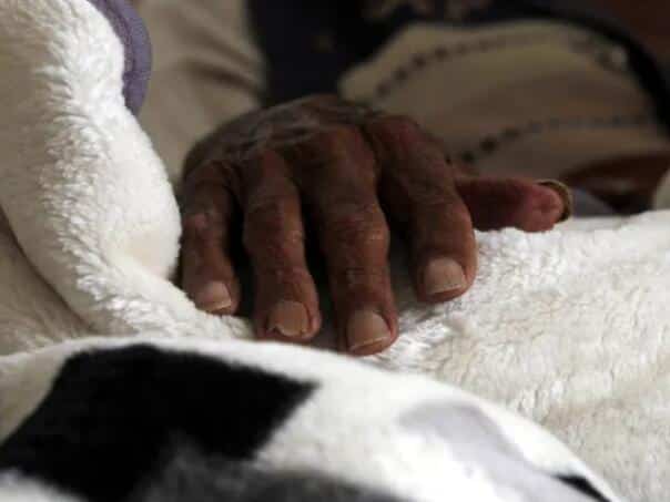 Cholera is raging in the northeast of Nigeria: Dozens dead, thousands sick