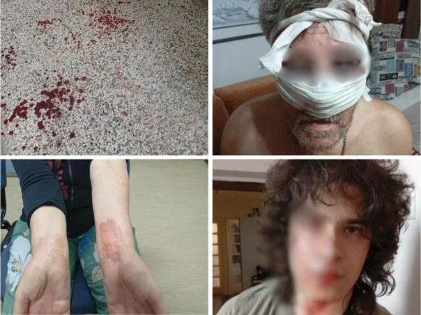 Brutally beaten family in Tuzla: One person arrested